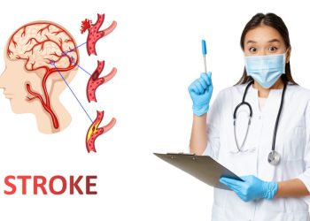 Begini Cara Pencegahan Stroke Usia Muda yang Harus Diketahui oleh Milenial