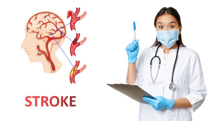 Begini Cara Pencegahan Stroke Usia Muda yang Harus Diketahui oleh Milenial
