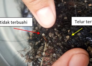 Contoh Soal dan Kunci Jawaban untuk SMK Jurusan Agrobisnis Kelas X