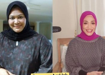 Dewi Hughes berhasil menurunkan berat badannya sebanyak 80 kg
