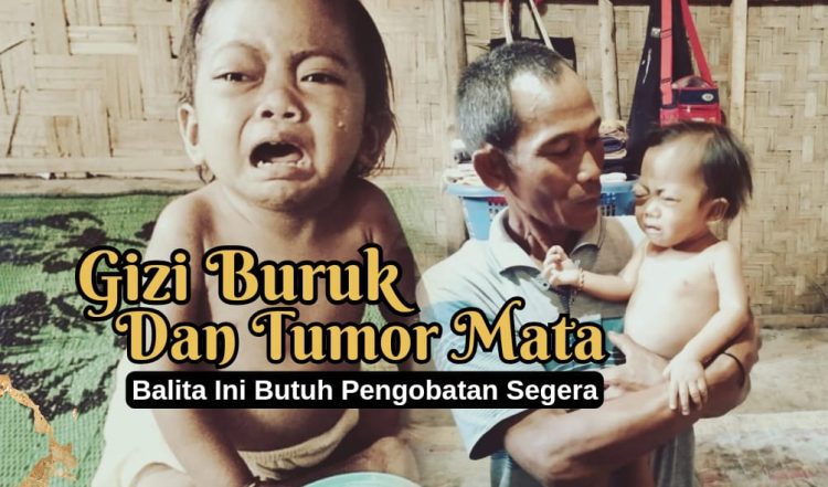 Dukungan Mendesak untuk Aneira: Kecil tapi Perlu Harapan