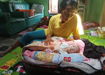 Fais Jaya, Bayi 1 Bulan yang Berjuang Melawan Penyakit Langka, Butuh Uluran Tangan