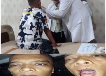 Cekcok di Gereja Berujung Pemukulan, Warga Laporkan Mahasiswa Teologi ke Polisi